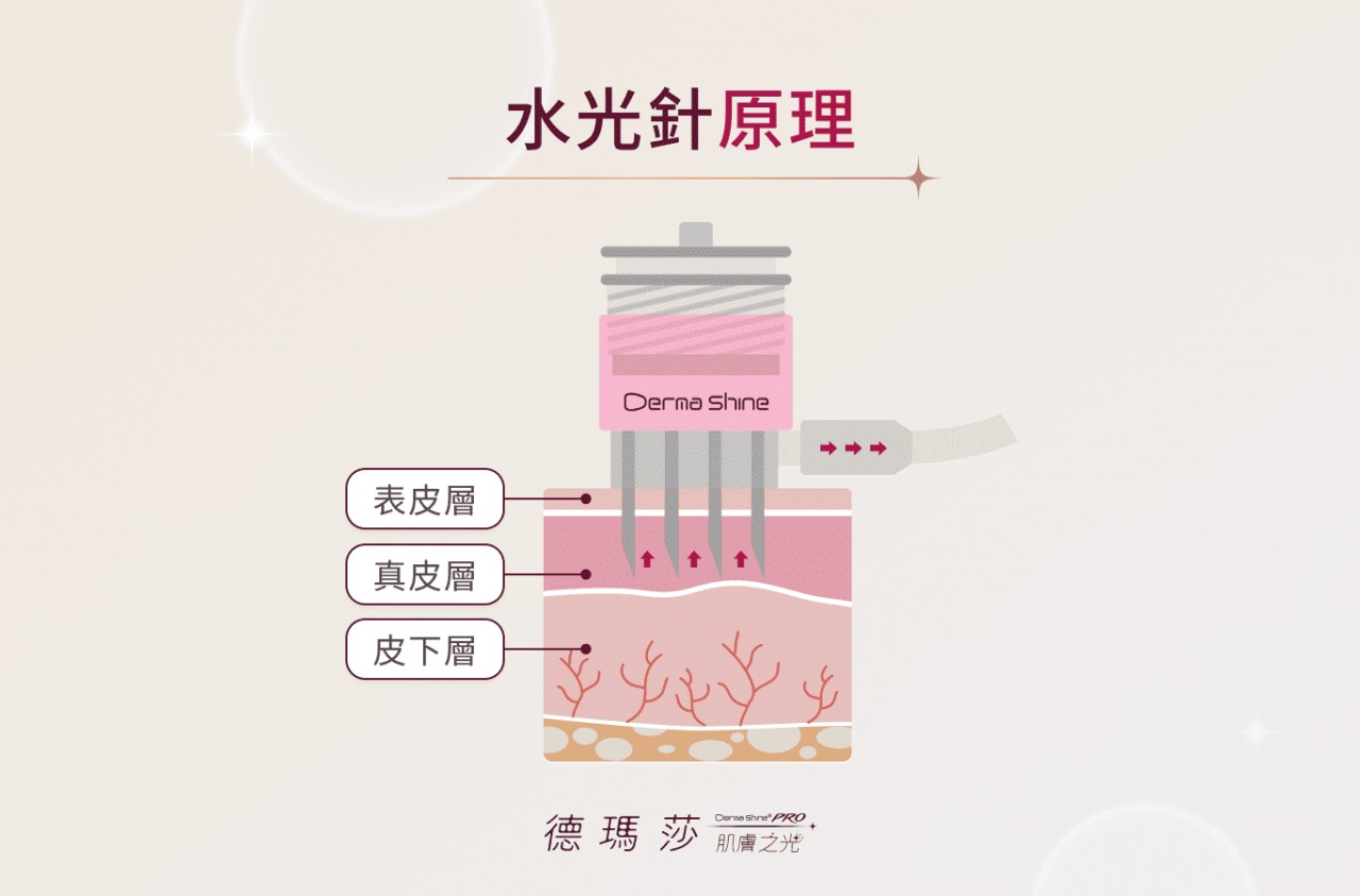 水光針原理